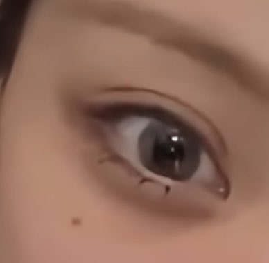 사진 2