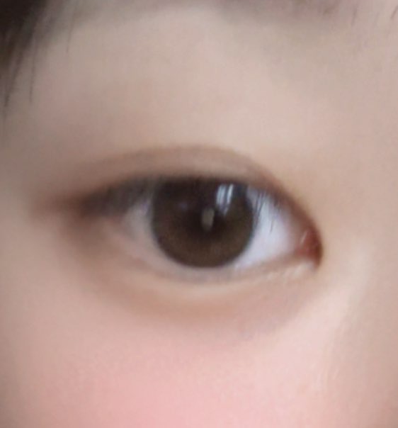 사진 1