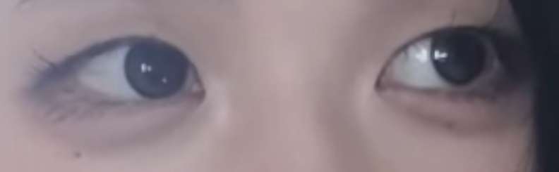 사진 1