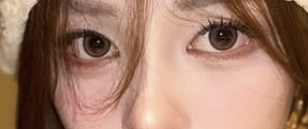 사진 2
