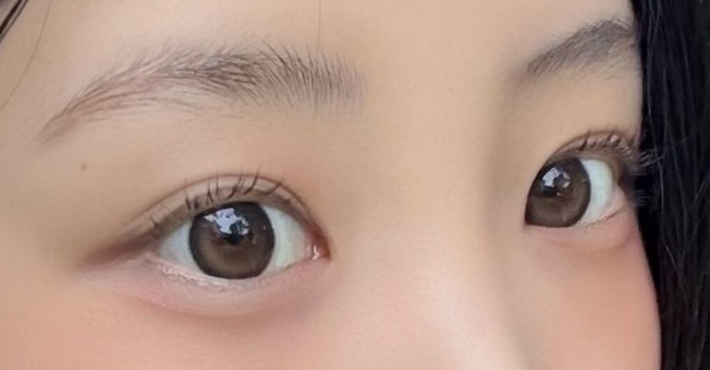 사진 2