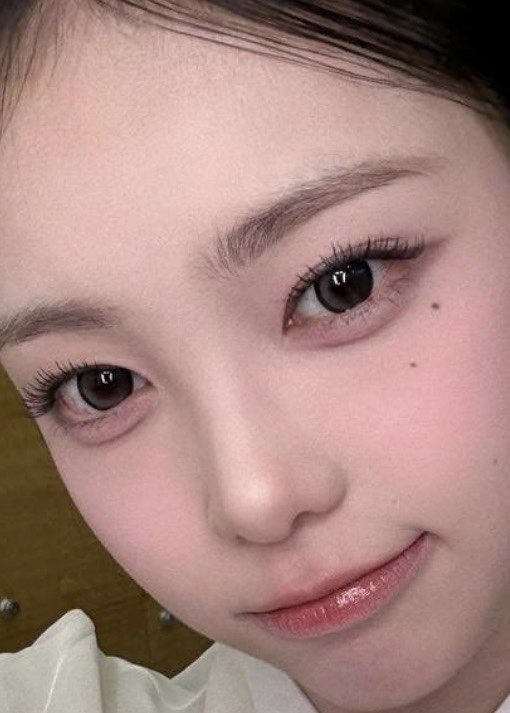 사진 2