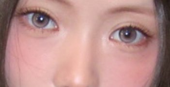 사진 2