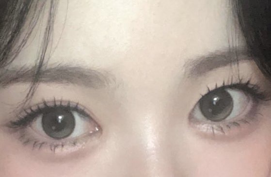 사진 1