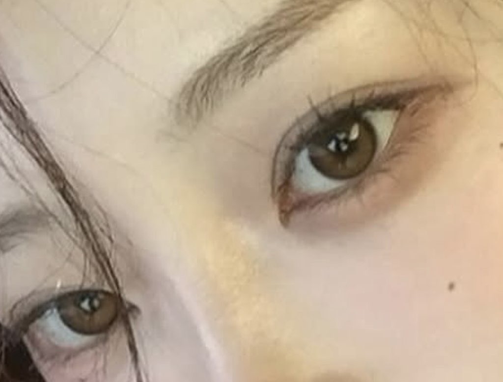 사진 1