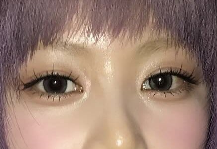 사진 1