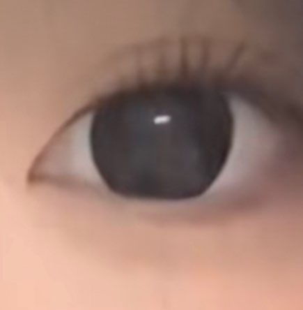 사진 1