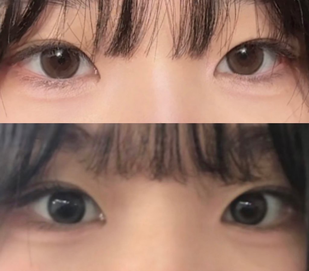 사진 1
