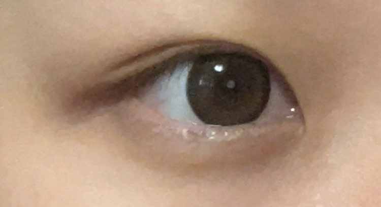 사진 2