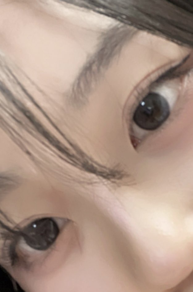 사진 2