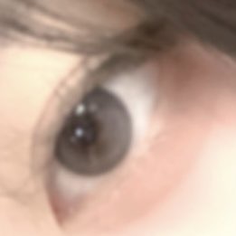 사진 1