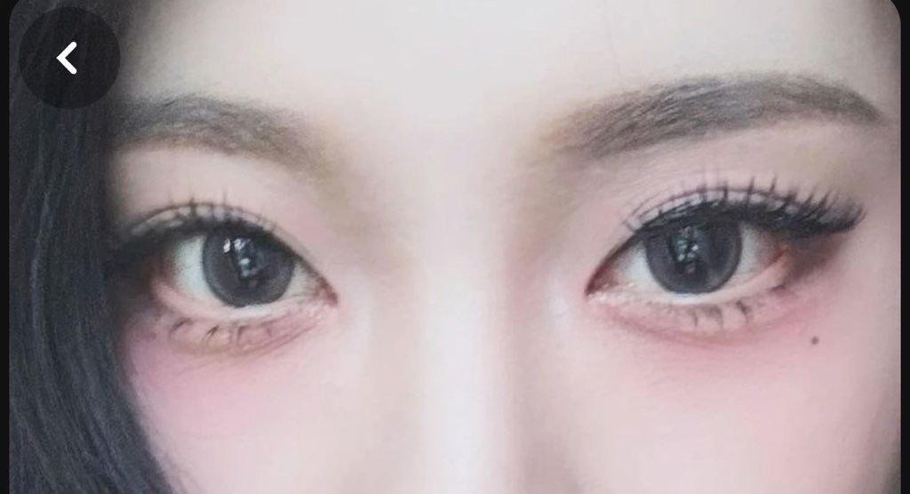 사진 1