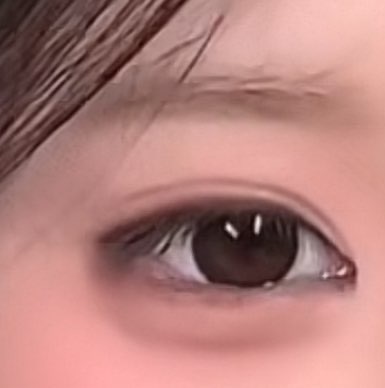 사진 2