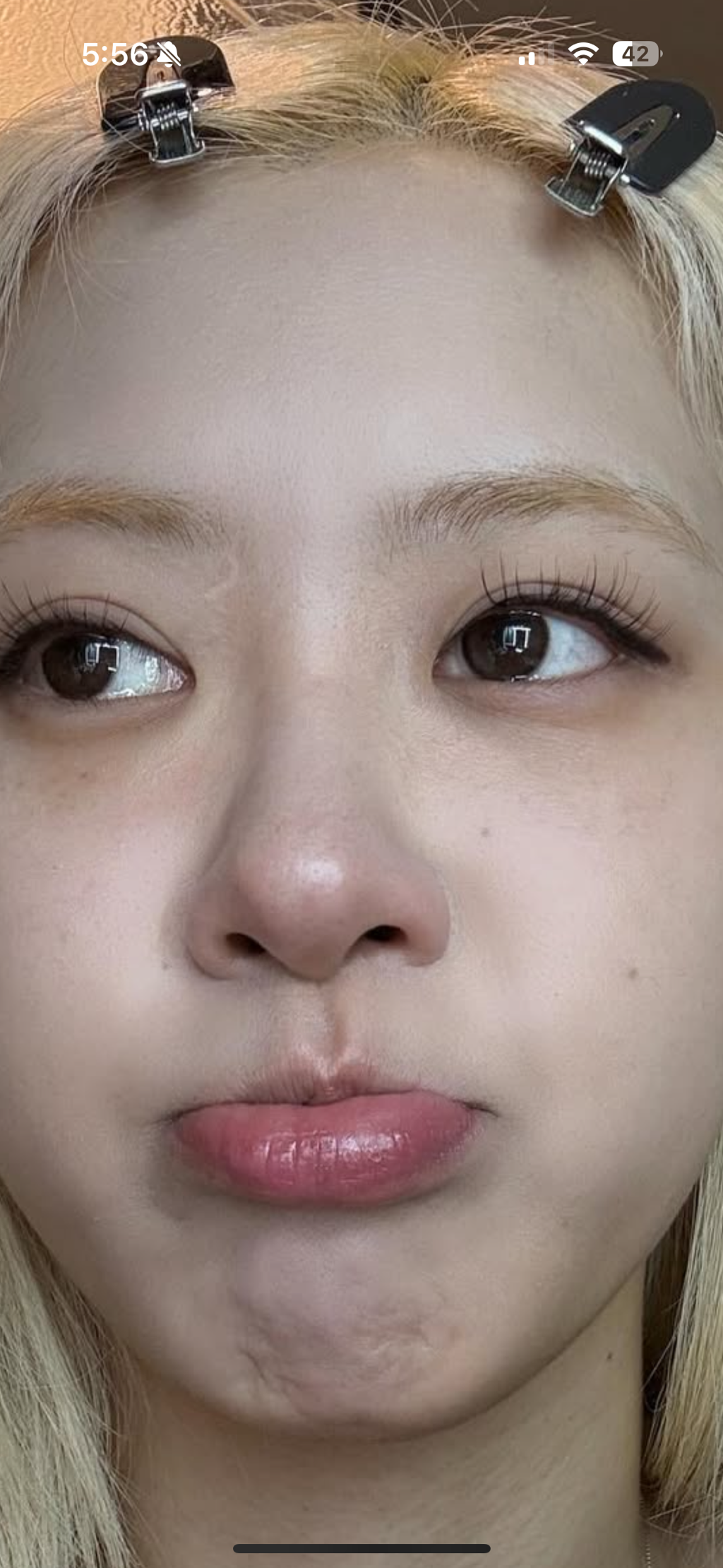 사진 1
