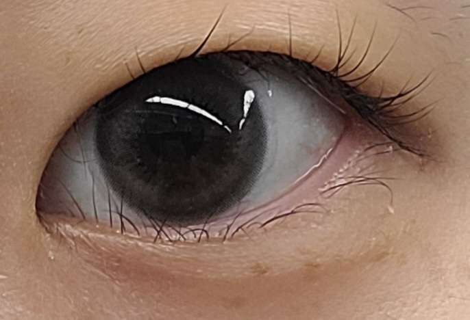 사진 1