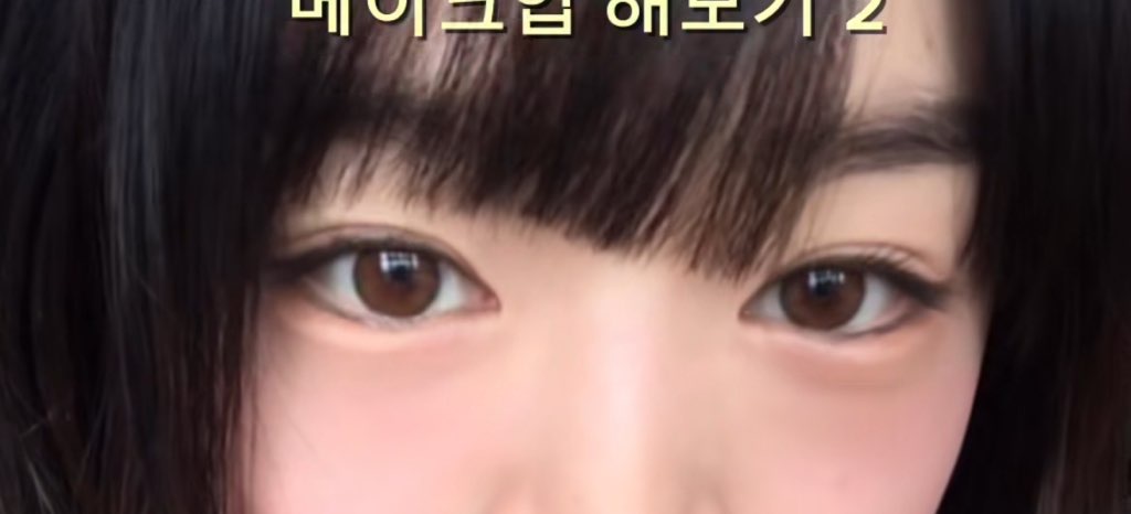 사진 2