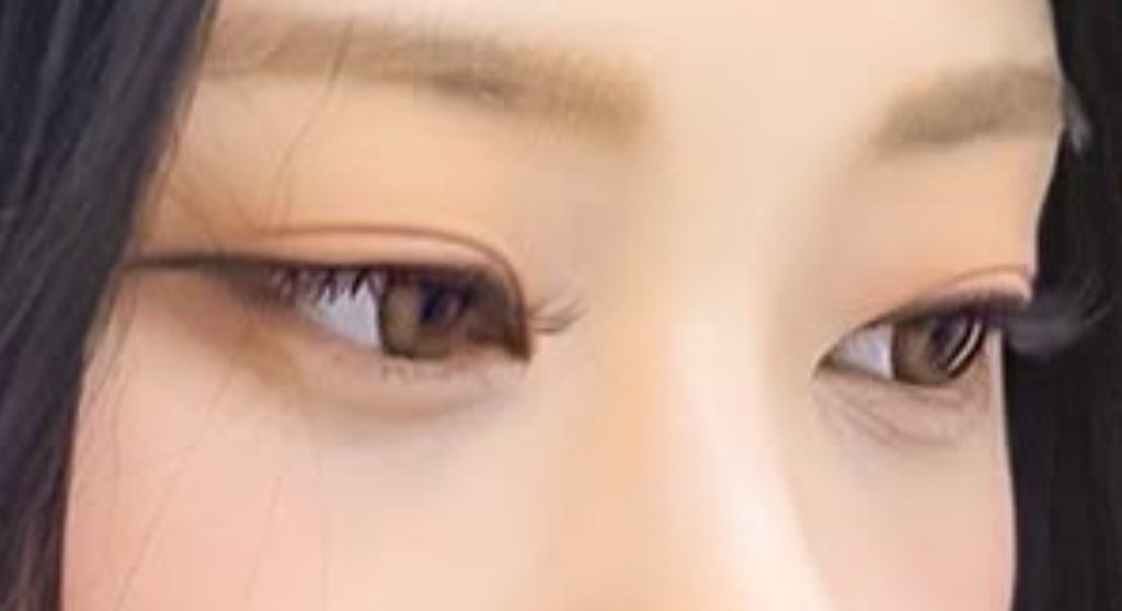 사진 1