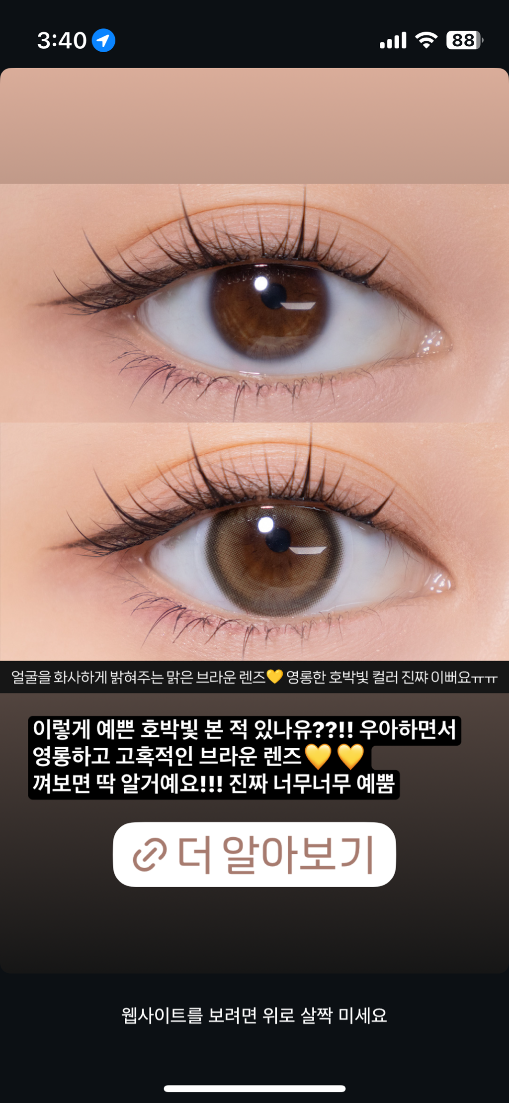 사진 2