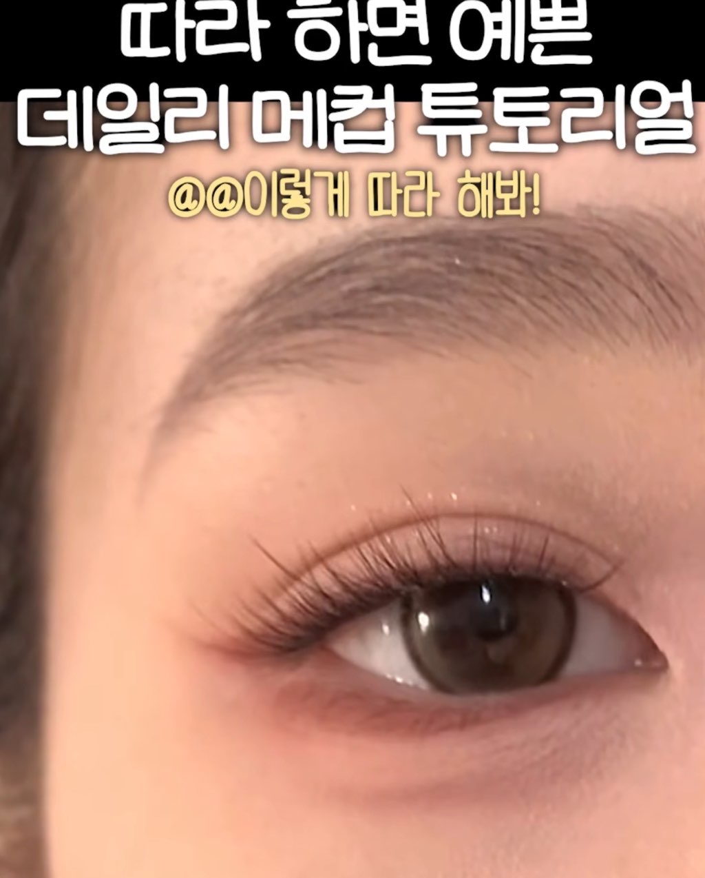 사진 1