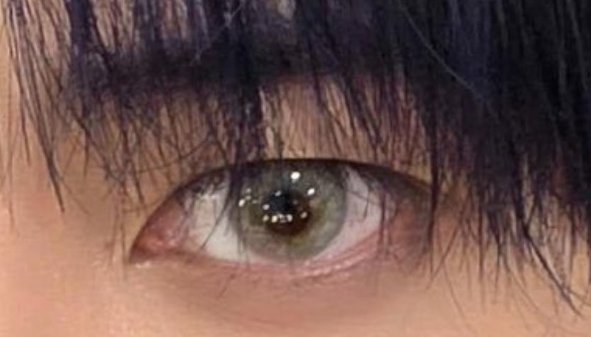 사진 1