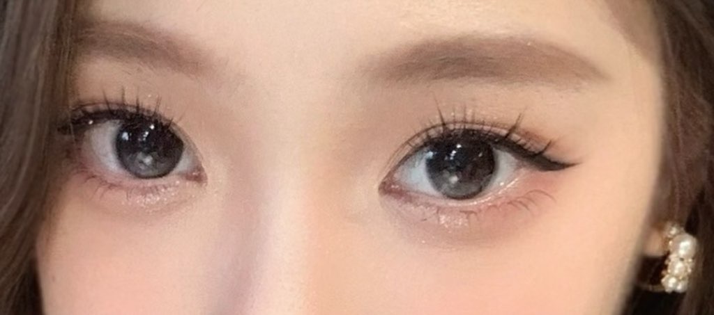 사진 1