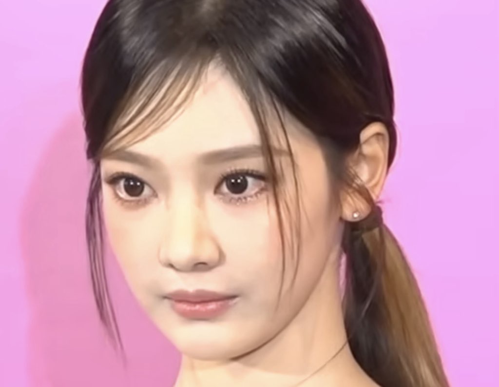 사진 2