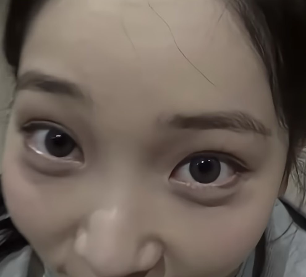 사진 1