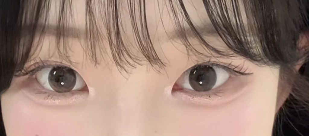 사진 2