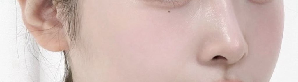 사진 1