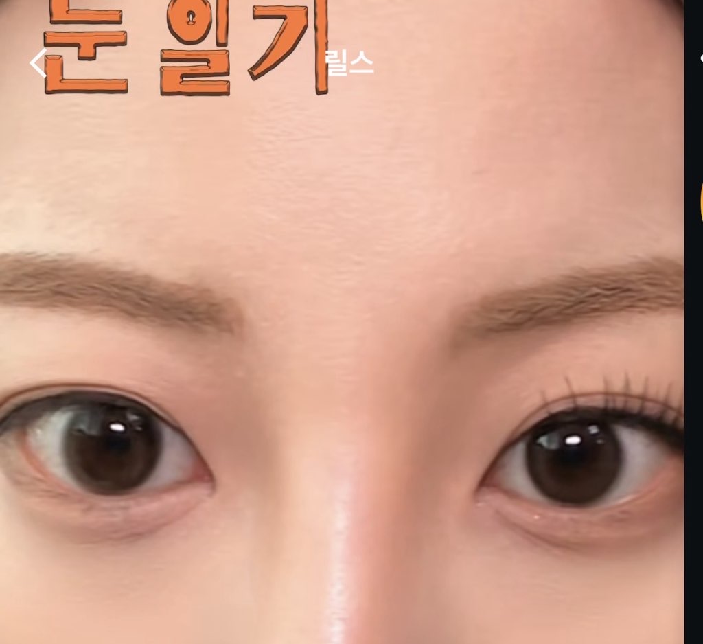 사진 1